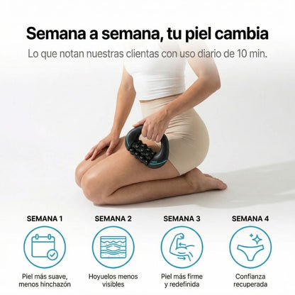VELRA™ - Masajeador Rotatorio Anticelulitis.