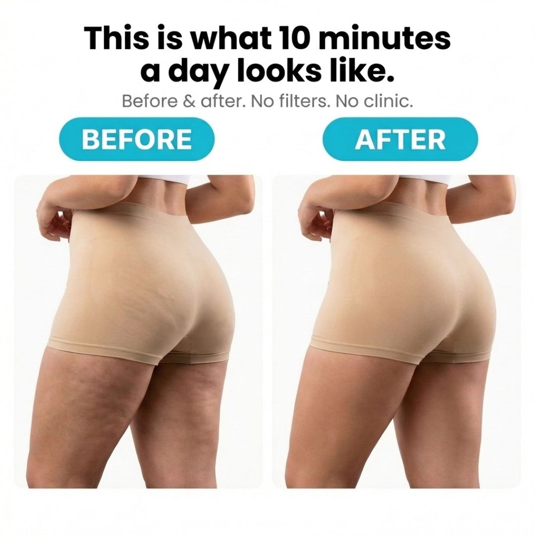 VELRA™ - Anti-Cellulite Rotating Massager