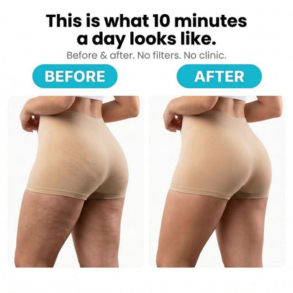 VELRA™ - Anti-Cellulite Rotating Massager
