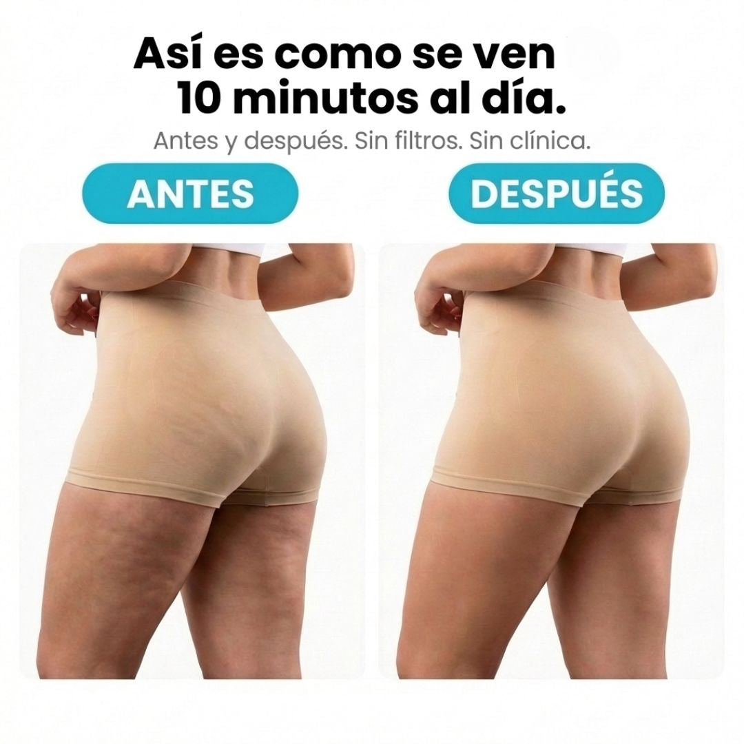VELRA™ - Masajeador Rotatorio Anticelulitis.