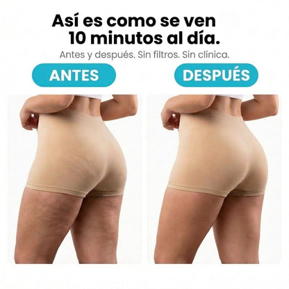 VELRA™ - Masajeador Rotatorio Anticelulitis.